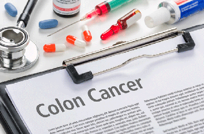 Colon cancer typed on a clipboard